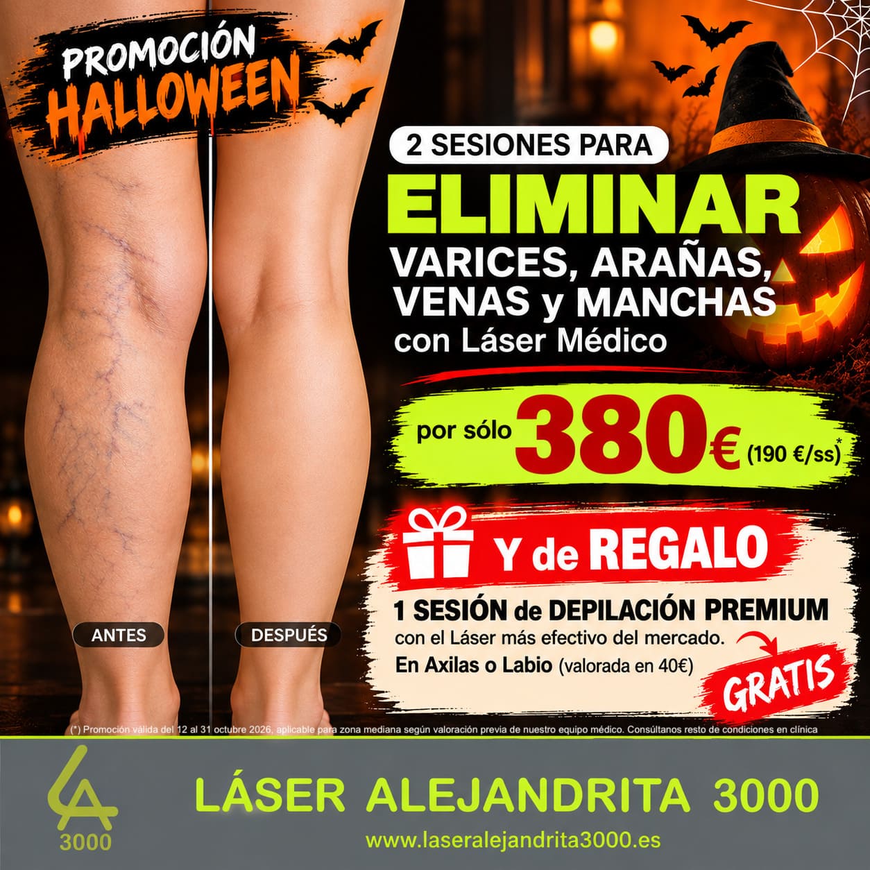 OFERTA HALLOWEEN para ELMINACIÓN de VARICES, ARAÑAS, MANCHAS y VENAS con LÁSER MÉDICO en TOLEDO