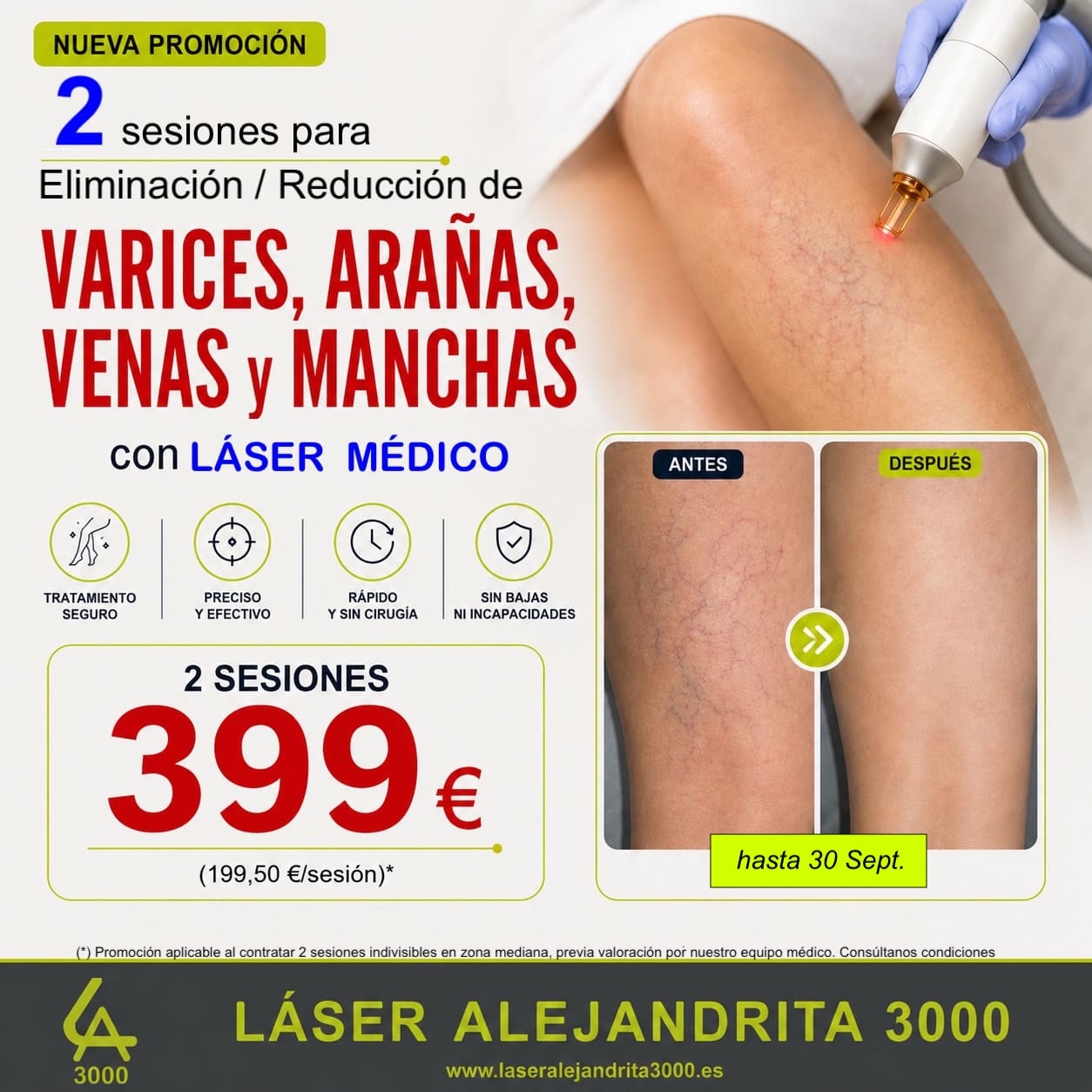 OFERTA en ELMINACIÓN de VARICES, ARAÑAS, MANCHAS y VENAS con LÁSER MÉDICO en TOLEDO